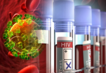 Laos reported more than 1,600 new HIV infections in the first nine months of 2025.